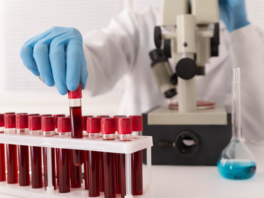 blood-test